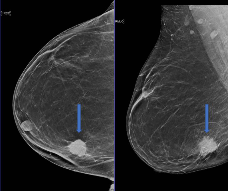 QT Ultrasound – Case_3_Picture1 - QT Ultrasound